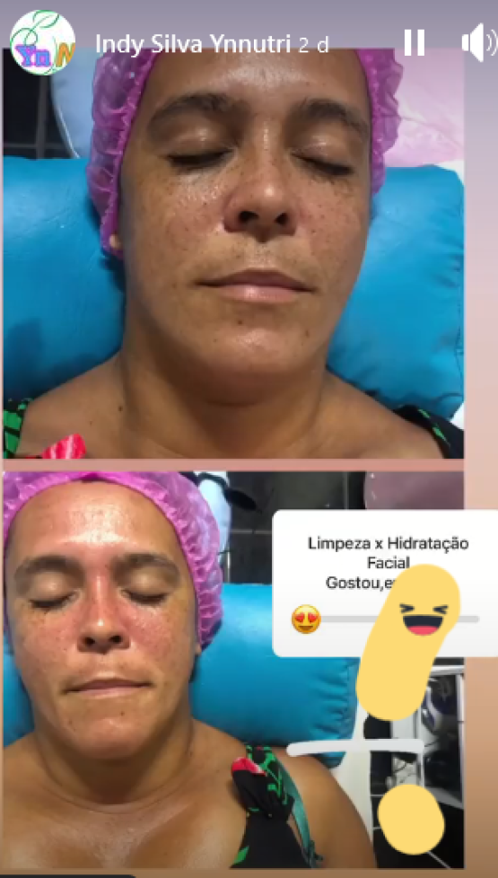 Limpeza de pele com Hidratação